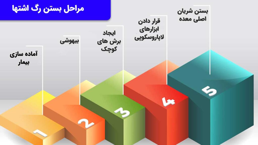 مراحل بستن رگ اشتها