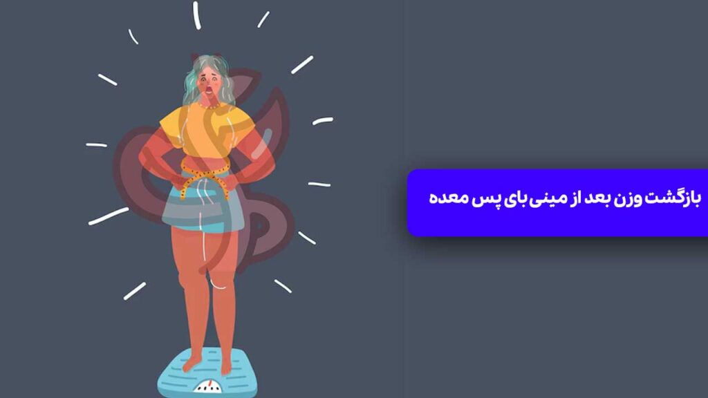 بازگشت وزن بعد از مینی بای پس معده