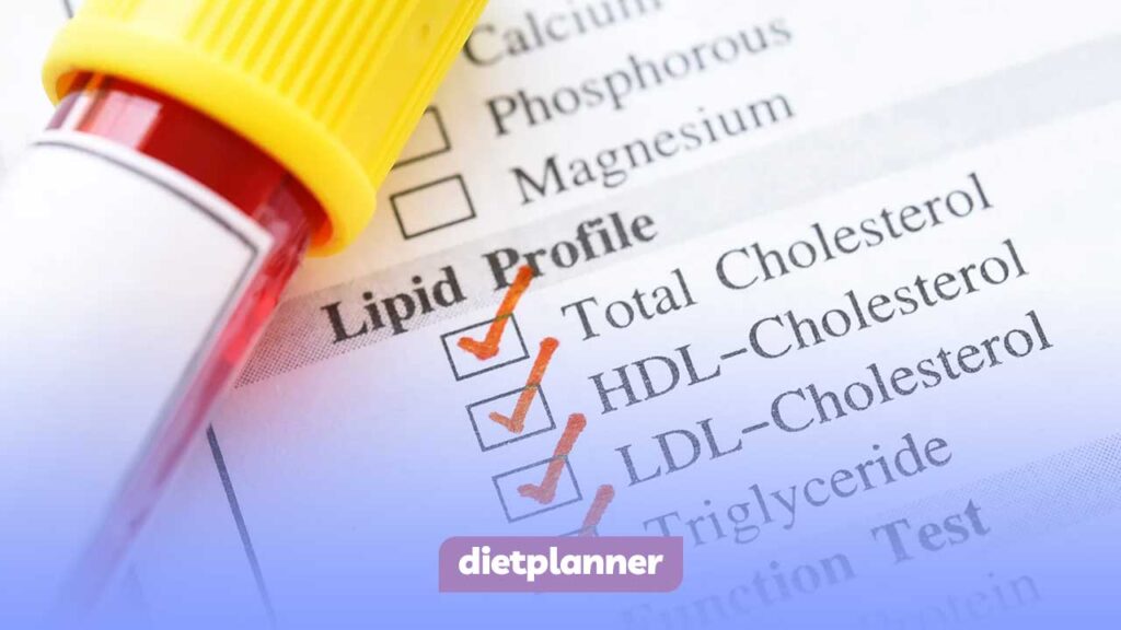 آزمایش چربی خون (Lipid Profile)