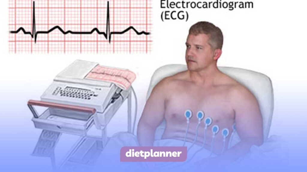 الکتروکاردیوگرام (ECG)